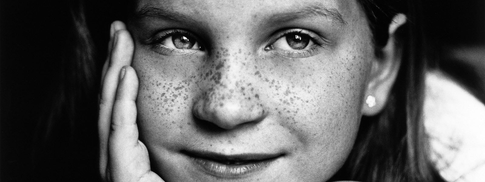 Close-up vom Mädchen mit Sommersprossen bei der Familienfotografie und Kinderfotografie mit Tageslicht in Hamburg Altona